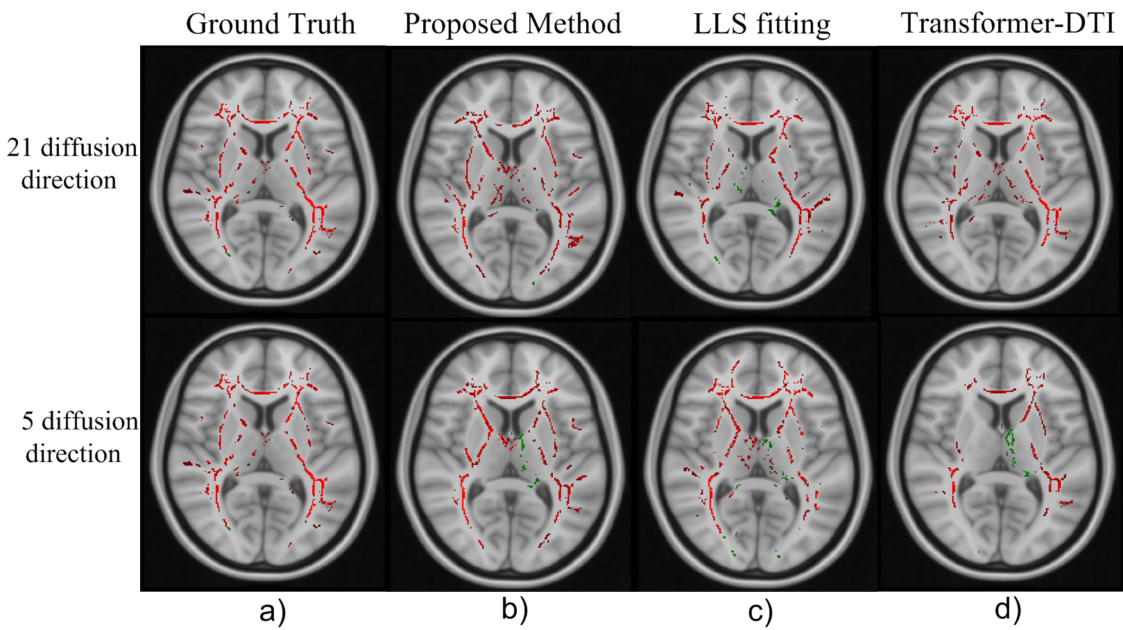 Uncinate Fasciculus TBSS