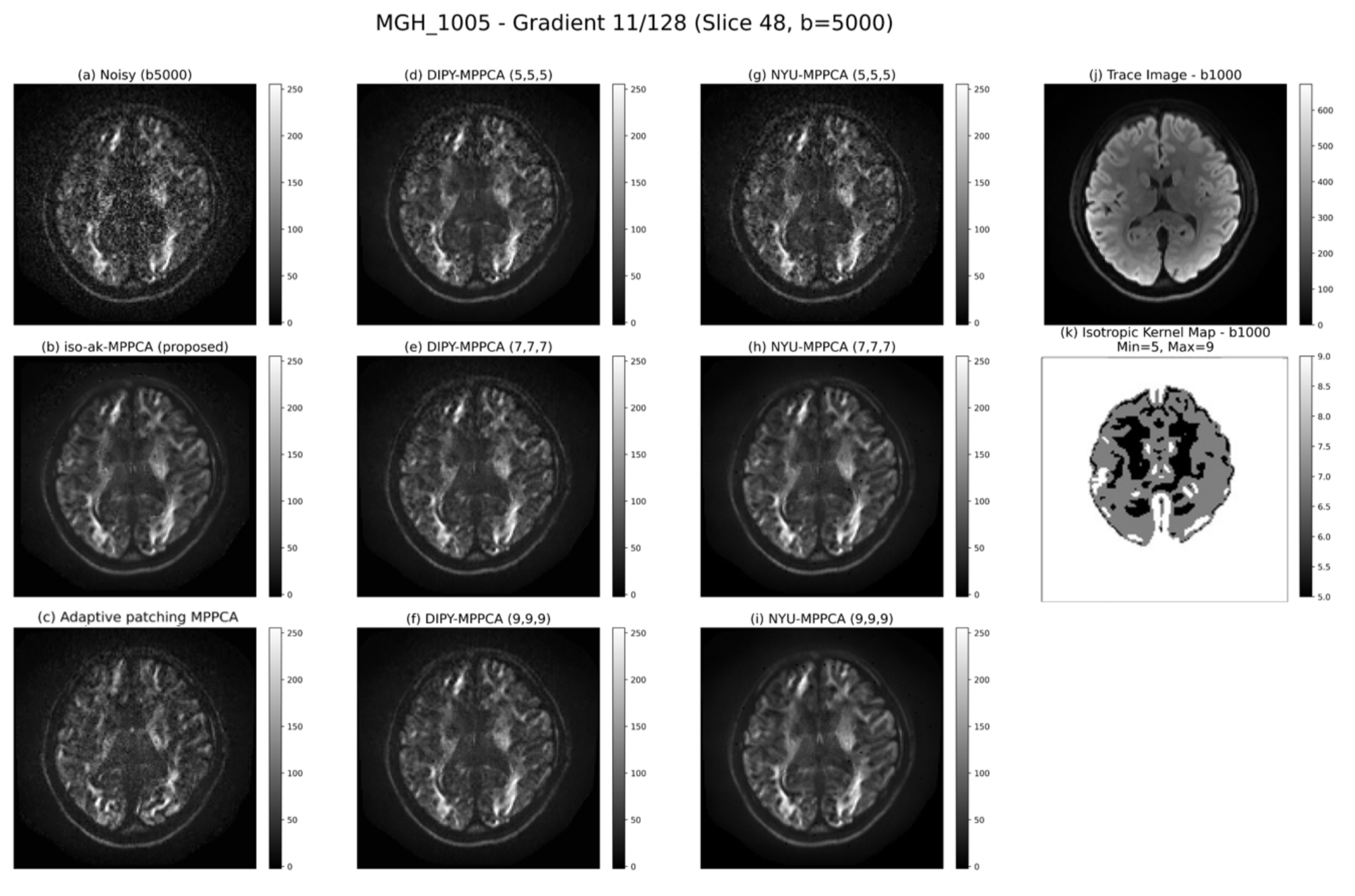 MGH-1005 denoising comparison — b=5000
