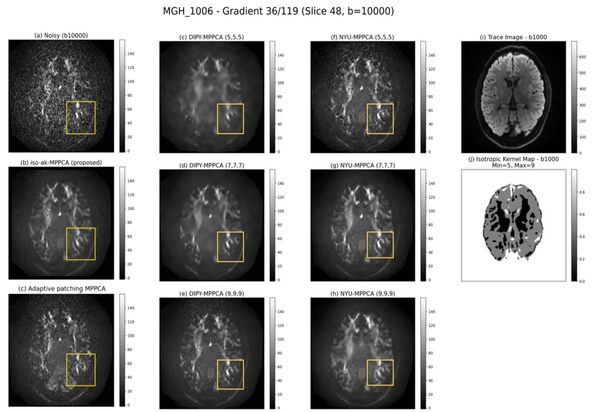 MGH-1006 denoising comparison — b=10000